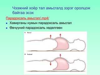 Чээжний хоёр тал амьсгалд зэрэг оролцож
байгаа эсэх
Парадоксаль амьсгал/.mp4/
 Хавирганы нумын парадоксаль амьсгал
 Өвчүүний парадоксаль хөдөлгөөн
 