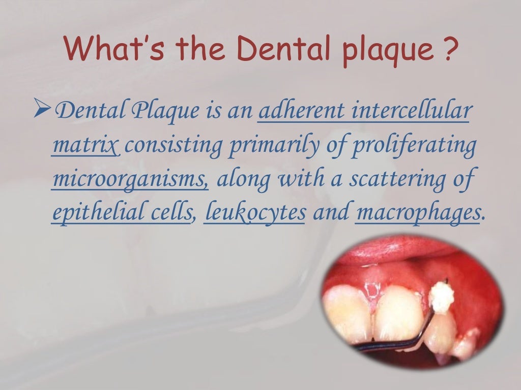 Dental plaque formation