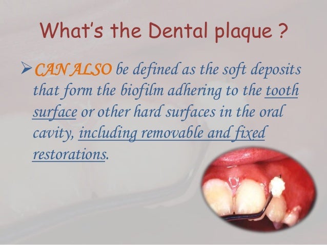 Dental plaque formation
