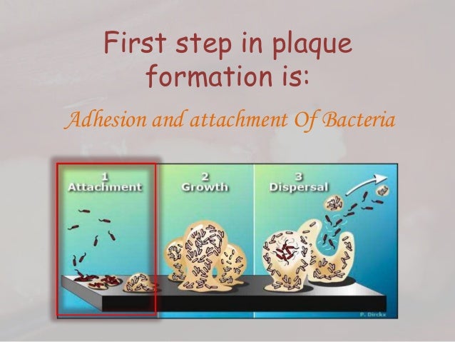 Dental plaque formation