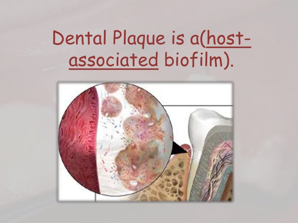 Dental plaque formation