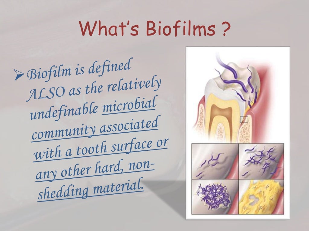 Dental plaque formation
