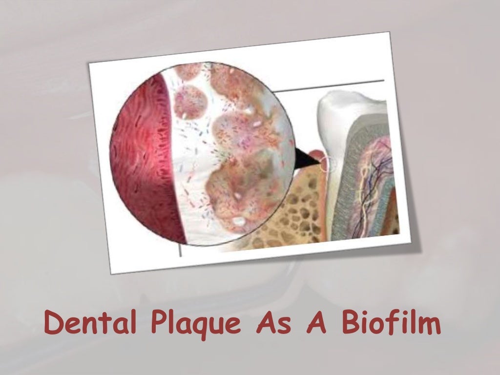 Dental plaque formation