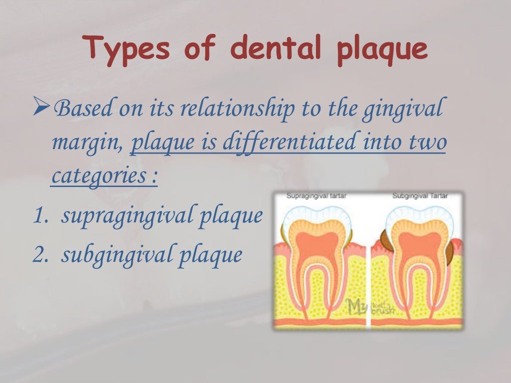 Dental plaque formation