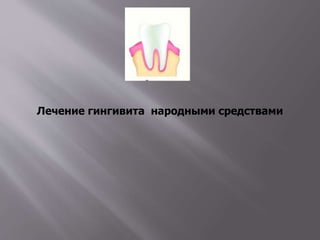 Лечение гингивита народными средствами
 