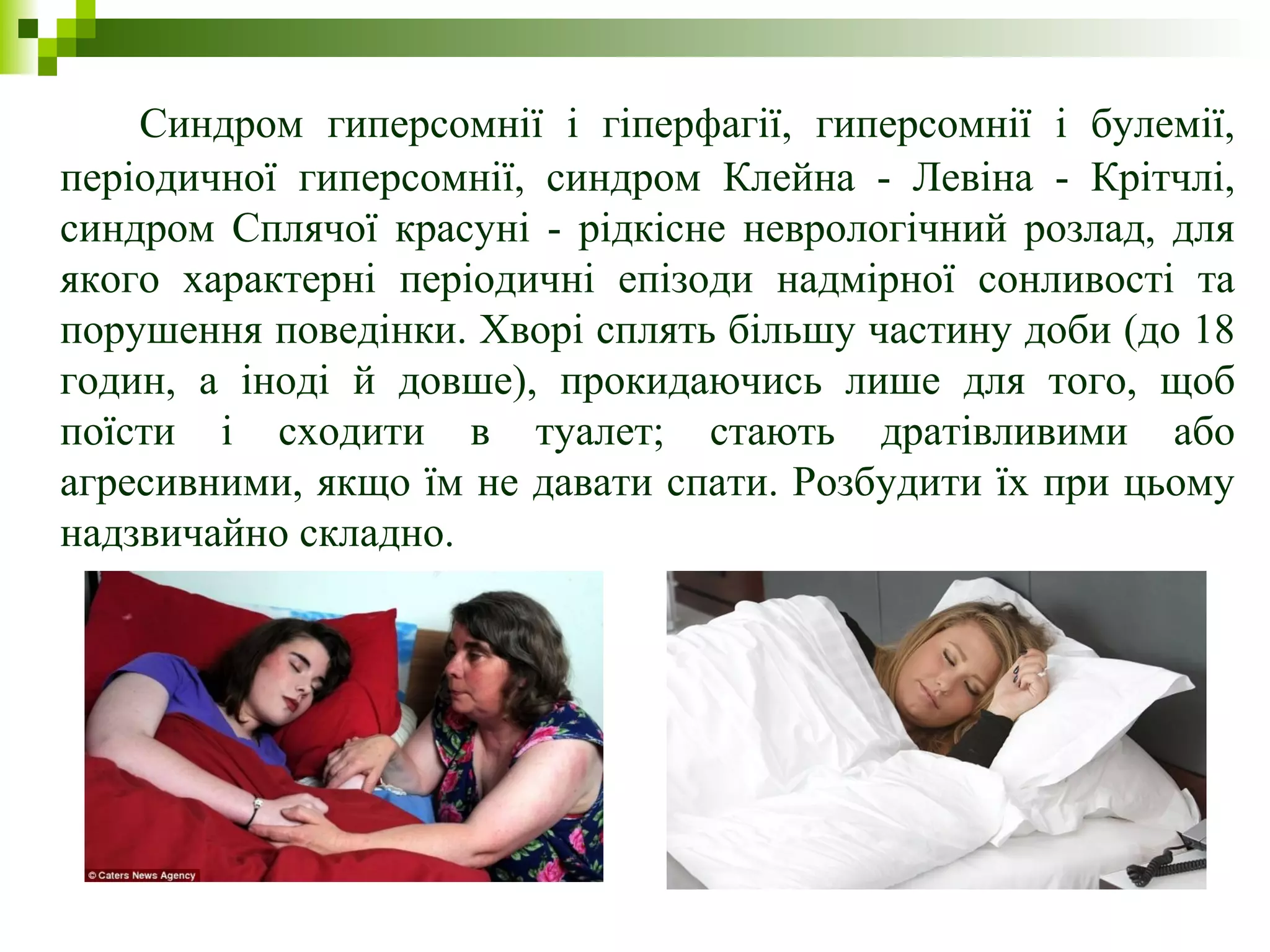 Синдром гиперсомнії і гіперфагії, гиперсомнії і булемії,
періодичної гиперсомнії, синдром Клейна - Левіна - Крітчлі,
синдром Сплячої красуні - рідкісне неврологічний розлад, для
якого характерні періодичні епізоди надмірної сонливості та
порушення поведінки. Хворі сплять більшу частину доби (до 18
годин, а іноді й довше), прокидаючись лише для того, щоб
поїсти і сходити в туалет; стають дратівливими або
агресивними, якщо їм не давати спати. Розбудити їх при цьому
надзвичайно складно.
 