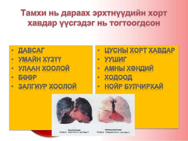 Тамхины хор хөнөөл