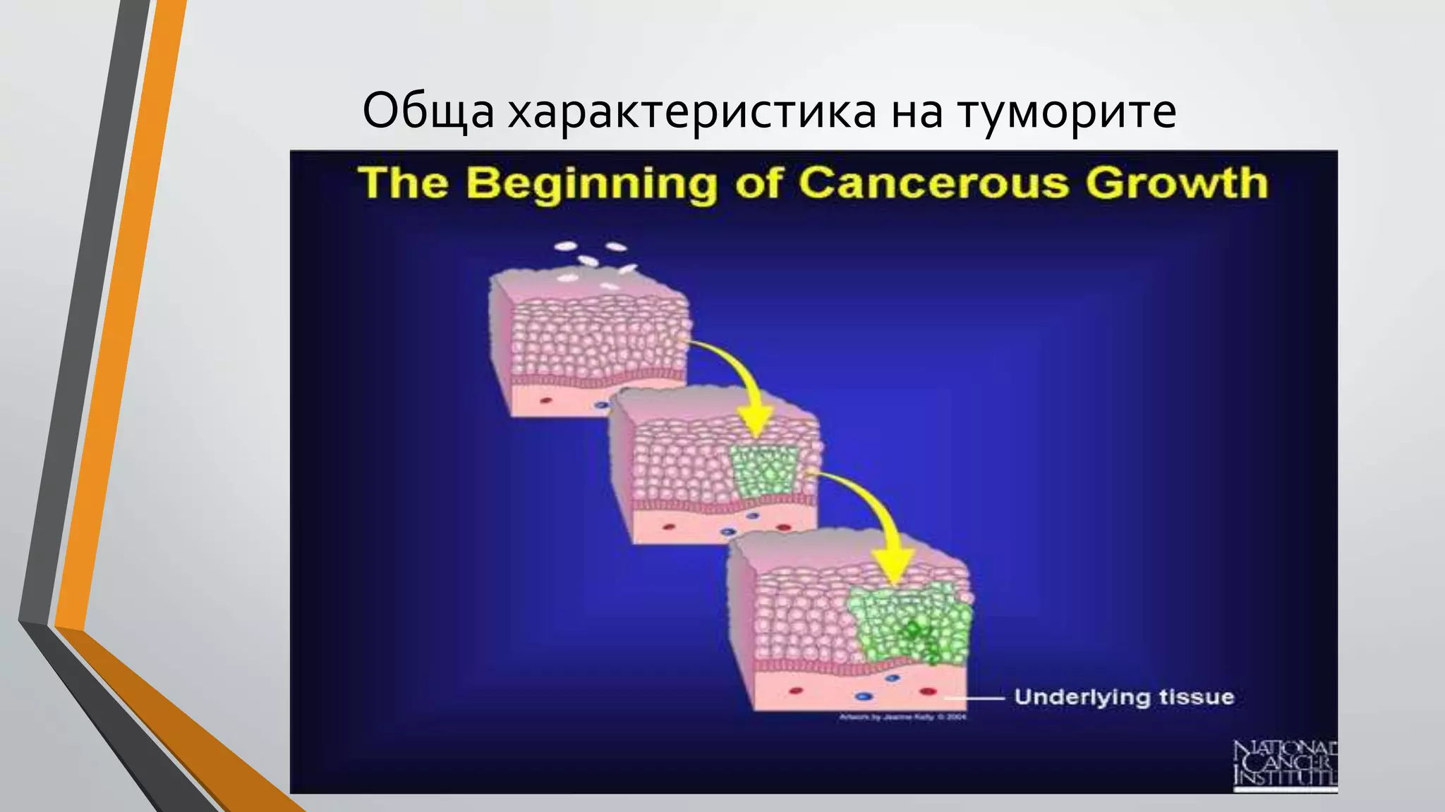 тумори обща характеристика | PPT