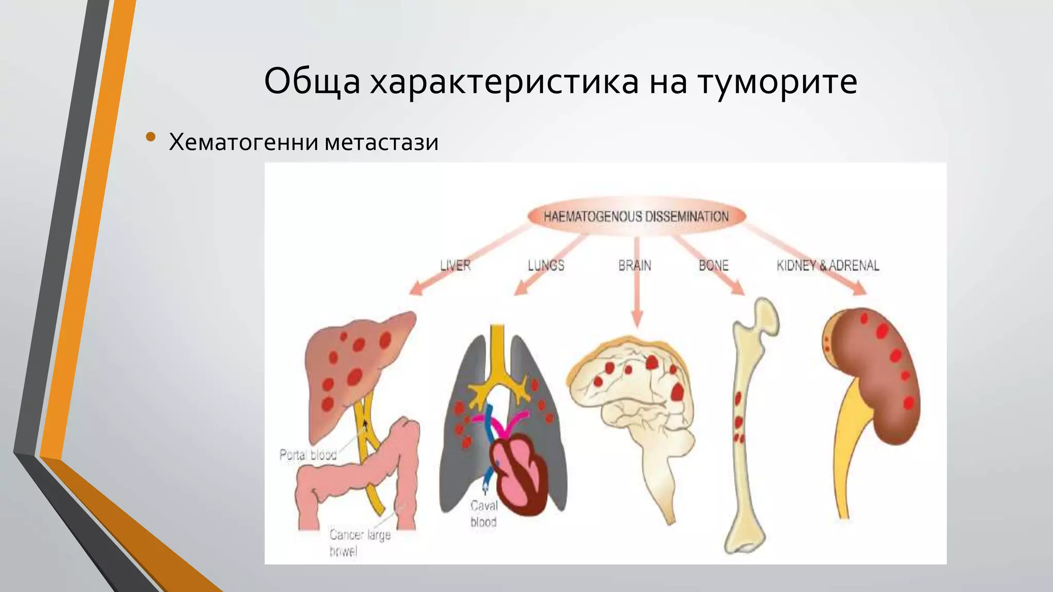 тумори обща характеристика | PPT