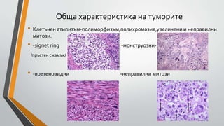 тумори обща характеристика | PPT
