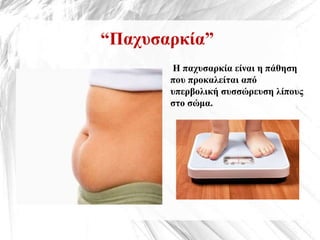 “Παχυσαρκία”
Η παχυσαρκία είναι η πάθηση
που προκαλείται από
υπερβολική συσσώρευση λίπους
στο σώμα.
 