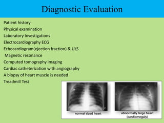 Diagnostic Evaluation
Patient history
Physical examination
Laboratory Investigations
Electrocardiography ECG
Echocardiogram(ejection fraction) & US
Magnetic resonance
Computed tomography imaging
Cardiac catheterization with angiography
A biopsy of heart muscle is needed
Treadmill Test
 