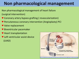 Non pharmacological management
Non pharmacological management of heart failure
(surgical intervention)
♥ Coronary artery bypass grafting ( revascularization)
♥ Percutaneous coronary intervention (Angioplasty) PCI
♥ Valve replacement
♥ Biventricular pacemaker
♥ Heart transplantation
♥ Left ventricular assist device
(LVAD)
 