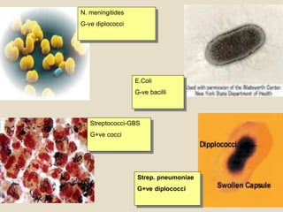 N. meningitides
G-ve diplococci
Streptococci-GBS
G+ve cocci
Strep. pneumoniae
G+ve diplococci
E.Coli
G-ve bacilli
 