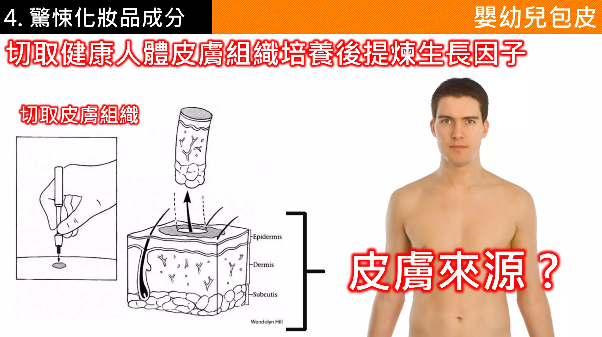 4. 驚悚化妝品成分 嬰幼兒包皮
切取健康人體皮膚組織培養後提煉生長因子
切取皮膚組織
皮膚來源 ?
 