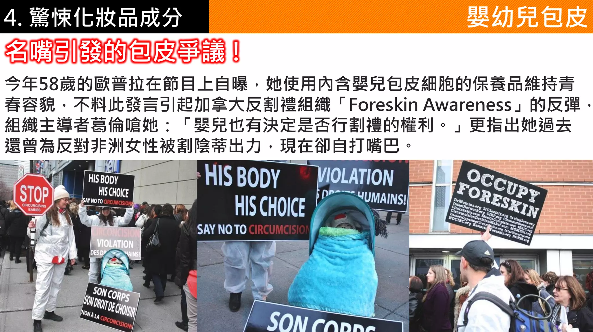 4. 驚悚化妝品成分 嬰幼兒包皮
今年58歲的歐普拉在節目上自曝，她使用內含嬰兒包皮細胞的保養品維持青
春容貌，不料此發言引起加拿大反割禮組織「Foreskin Awareness」的反彈，
組織主導者葛倫嗆她：「嬰兒也有決定是否行割禮的權利。」更指出她過去
還曾為反對非洲女性被割陰蒂出力，現在卻自打嘴巴。
名嘴引發的包皮爭議 !
 