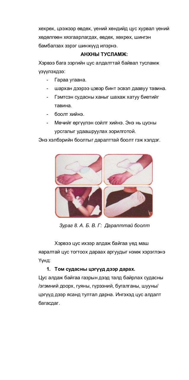 Осол гэмтлийн үед үзүүлэх анхны тусламж