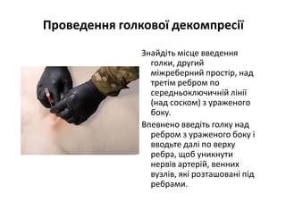 Проведення голкової декомпресії
Знайдіть місце введення
голки, другий
міжреберний простір, над
третім ребром по
середньоключичній лінії
(над соском) з ураженого
боку.
Впевнено введіть голку над
ребром з ураженого боку і
вводьте далі по верху
ребра, щоб уникнути
нервів артерій, венних
вузлів, які розташовані під
ребрами.
 