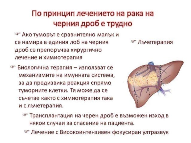 рак на черен дроб