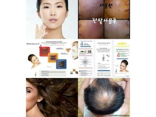 줄기세포화장품