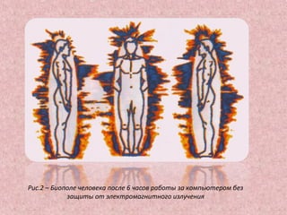 Рис.2 – Биополе человека после 6 часов работы за компьютером без
защиты от электромагнитного излучения
 