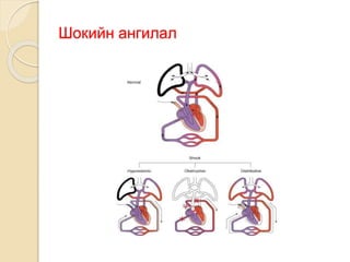 шокын үеийн яаралтай тусламж