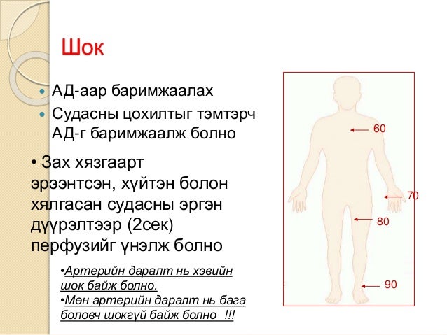 шокын үеийн яаралтай тусламж