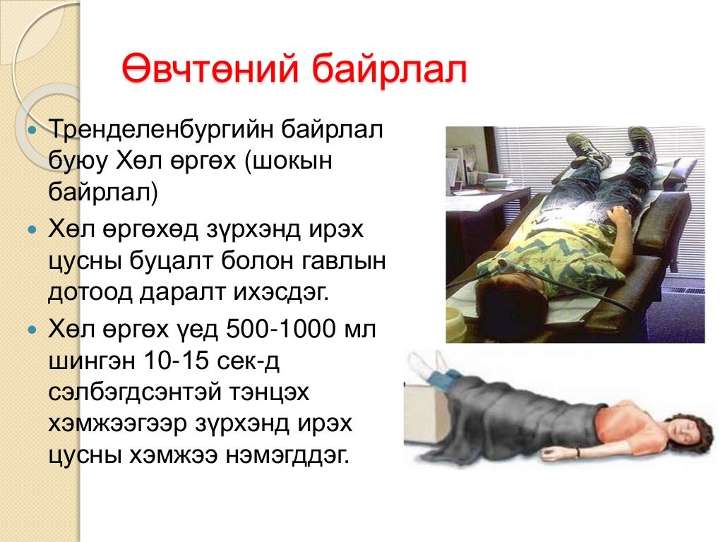 шокын үеийн яаралтай тусламж