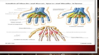 гар, сарвууны гэмтэл | PPT
