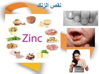 ‫انضوك‬ ‫وقص‬
 