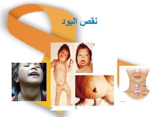 ‫انُىد‬ ‫وقص‬
 