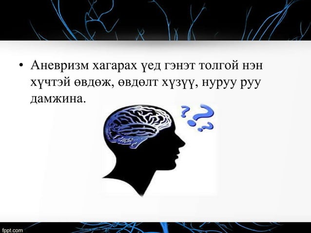 аалзавчийн доорх цус харвалт | PPT