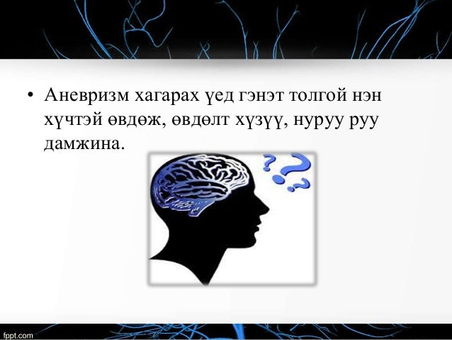 аалзавчийн доорх цус харвалт