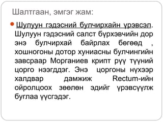 Шалтгаан, эмгэг жам:
Шулуун гэдэсний булчирхайн үрэвсэл.
Шулуун гэдэсний салст бүрхэвчийн дор
энэ булчирхай байрлах бөгөөд ,
хошногоны дотор хуниасны булчингийн
завсраар Морганиев крипт рүү түүний
цорго нээгддэг. Энэ цоргоны нүхээр
халдвар дамжиж Rectum-ийн
ойролцоох зөөлөн эдийг үрэвсүүлж
буглаа үүсгэдэг.
 