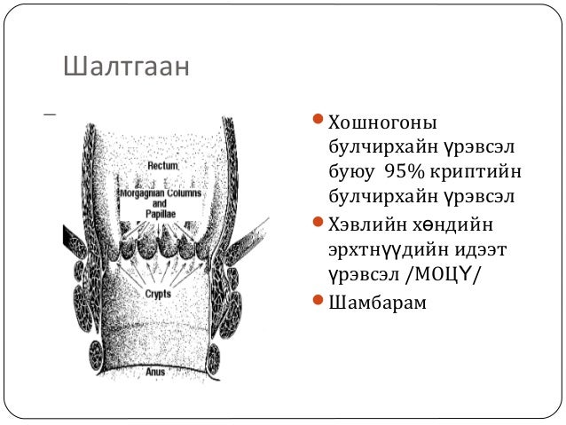 парапроктит