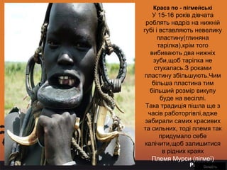 Page 15
Краса по - пігмейські
У 15-16 років дівчата
роблять надріз на нижній
губі і вставляють невелику
пластину(глиняна
тарілка),крім того
вибивають два нижніх
зуби,щоб тарілка не
стукалась.З роками
пластину збільшують.Чим
більша пластина тим
більший розмір викупу
буде на весіллі.
Така традиція пішла ще з
часів работоргівлі,адже
забирали самих красивих
та сильних, тоді племя так
придумало себе
калічити,щоб залишитися
в рідних краях
Племя Мурси (пігмеї)
ВведітьВведіть
 