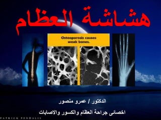 ‫الدكتور‬/‫منصور‬ ‫عمرو‬
‫واالصابات‬ ‫والكسور‬ ‫العظام‬ ‫جراحة‬ ‫اخصائى‬
 