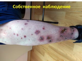 Собственное наблюдение
 