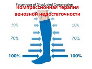 Компрессионная терапия
венозной недостаточности
 