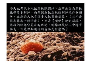 今天也有很多人把扁桃腺割掉，並不是因為扁桃
腺發炎要割掉，而是認為把扁桃腺割掉來作為預
防，在座的人也有很多人把盲腸割掉，（並不是
因為作為一種治療），而是【順便】把它割掉，
因我們認為它是沒有用的，割掉以後就不會得盲
腸炎。可是你知道你的盲腸是什麼嗎？
 