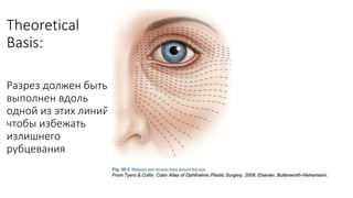 Theoretical
Basis:
Разрез должен быть
выполнен вдоль
одной из этих линий,
чтобы избежать
излишнего
рубцевания
 