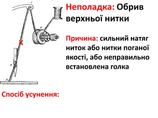 Неполадка: Обрив
верхньої нитки
Причина: сильний натяг
ниток або нитки поганої
якості, або неправильно
встановлена голка
Спосіб усунення:
Х
 
