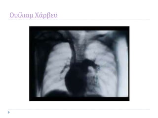 Ουίλιαμ Χάρβεϋ
 