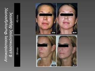 42ετών39ετών
 