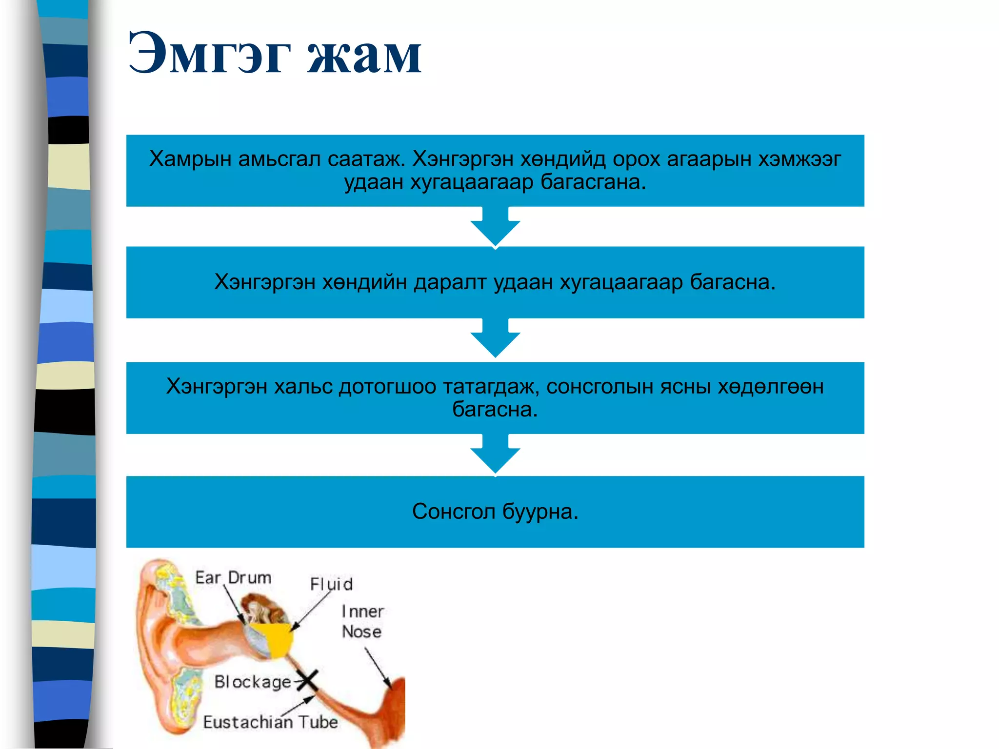 Дунд чихний архаг үрэвсэл | PPT