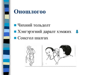 Оношлогоо
 Чихний тольдолт
 Хэнгэрэгний даралт хэмжих
 Сонсгол шалгах
 