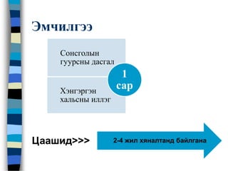 Эмчилгээ
Сонсголын
гуурсны дасгал
Хэнгэргэн
хальсны иллэг
1
сар
2-4 жил хяналтанд байлганаЦаашид>>>
 