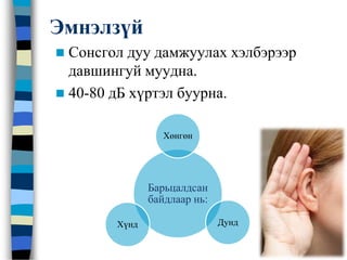 Эмнэлзүй
 Сонсгол дуу дамжуулах хэлбэрээр
давшингуй муудна.
 40-80 дБ хүртэл буурна.
Барьцалдсан
байдлаар нь:
Хөнгөн
ДундХүнд
 