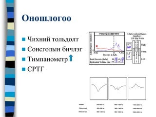 Оношлогоо
 Чихний тольдолт
 Сонсголын бичлэг
 Тимпанометр
 СРТГ
 