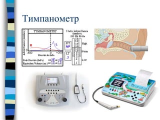 Тимпанометр
 
